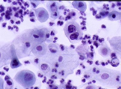 明美成像系統(tǒng)MD30用于TCT液基細胞分析