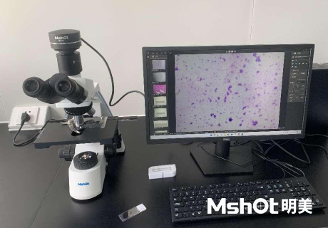 熒光生物顯微鏡應用于ANA-HEp2免疫熒光診斷