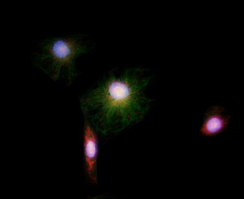 �ɹ��@΢�zӰ